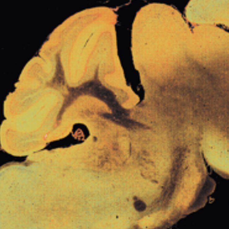 Neuroscience